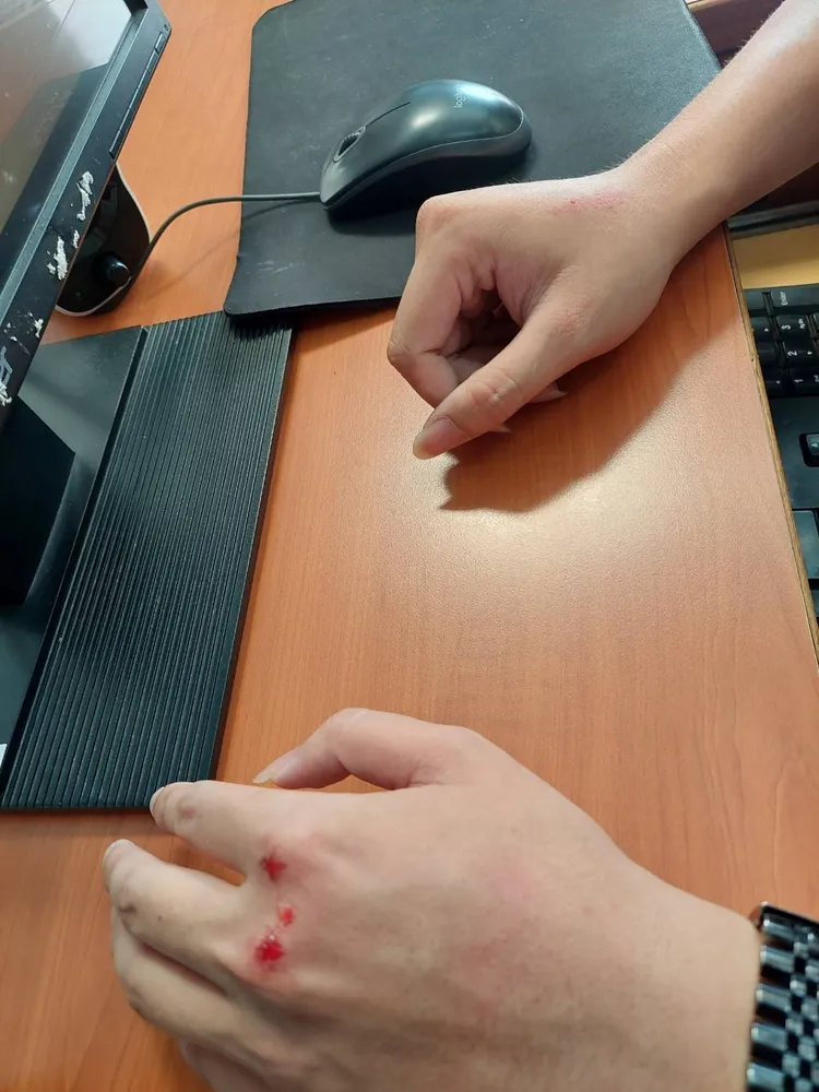 警方取締假車牌，女子激烈反抗，造成3名員警皮肉傷。翻攝畫面