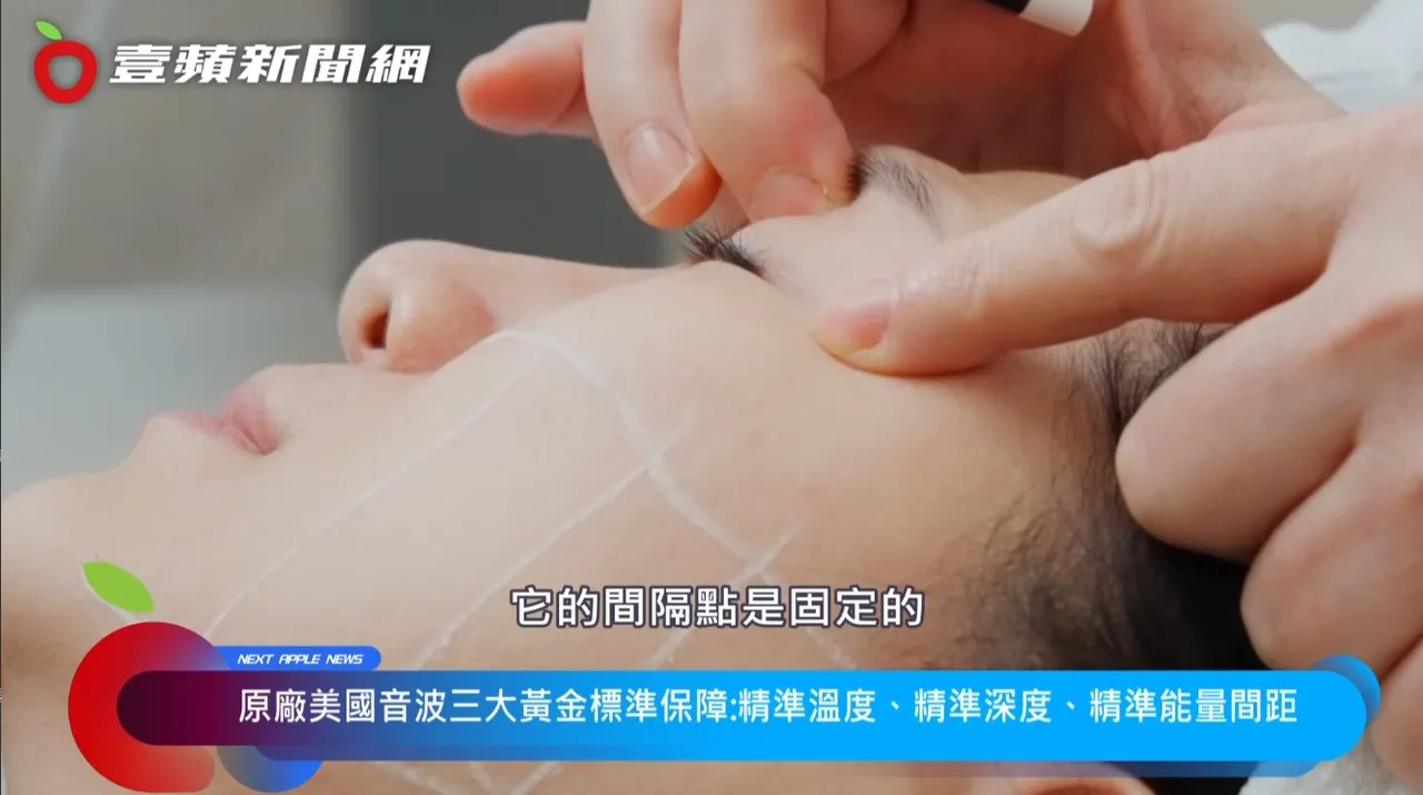 筋膜层在太阳穴比较薄,在脸颊厚度会变厚,唯有美国音波独有专利透视超音波科技,才能让医师精准辨识。