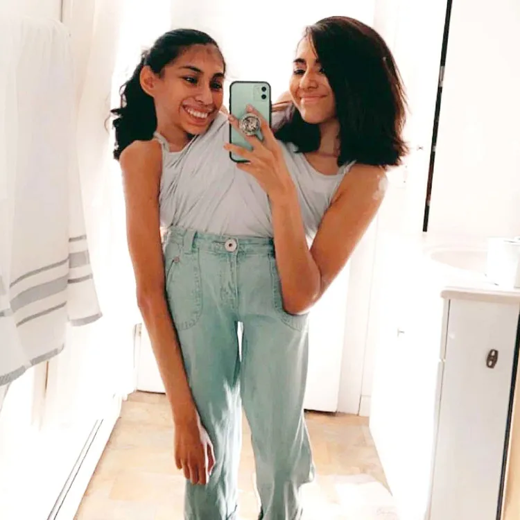 2人共用軀幹和骨盆。翻攝自X