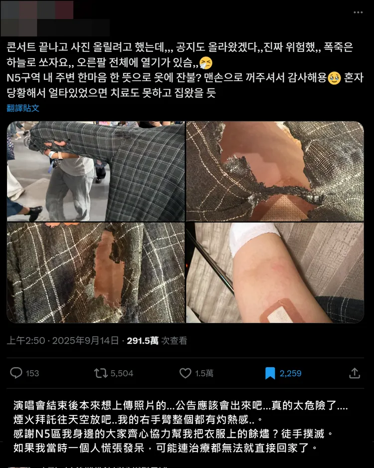 SEVENTEEN昨晚看第1場演出，因煙火火苗掉進觀眾席，粉絲襯衫被燒破洞，右手臂燙傷。翻攝粉絲X／壹蘋新聞網翻譯