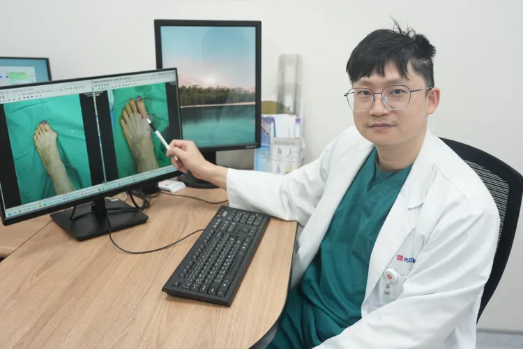 洪煒竣醫師說，拇趾外翻如拖太久治療，最後恐致關節炎風險。光田醫院提供