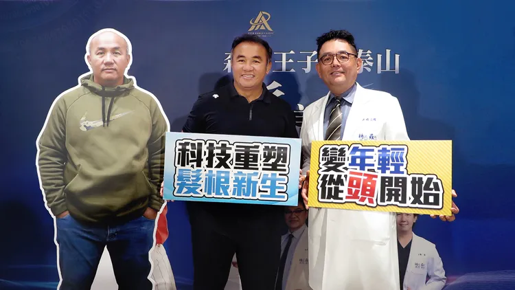 張泰山過去植髮前後。資料照