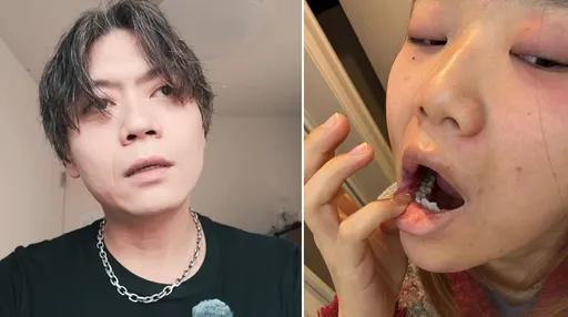 Ryu「后悔为妳离婚」激怒画家女友!她拿杯垫砸他被家暴耳鸣3个月