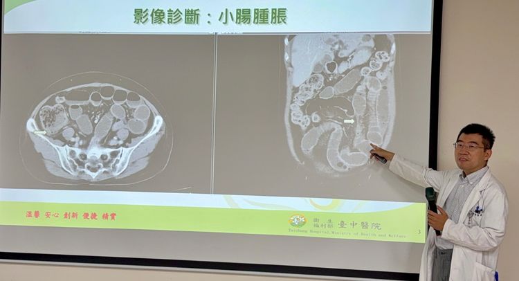 中秋烤肉悲劇了！肉還沒熟就搶著吃　高中生急性腸胃炎連拉3天