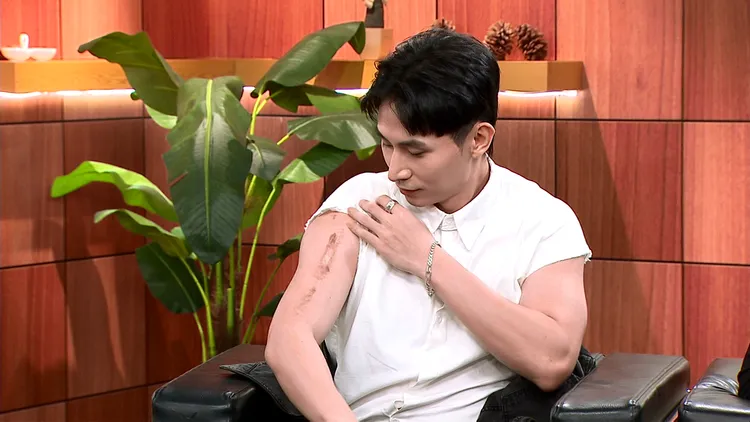 林家佑開刀後在手臂留下20公分疤痕。年代提供