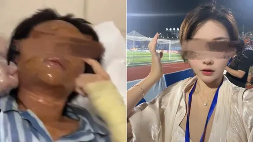 网美取货「看一眼就爆炸」 他自制炸弹包裹放门口把她毁容