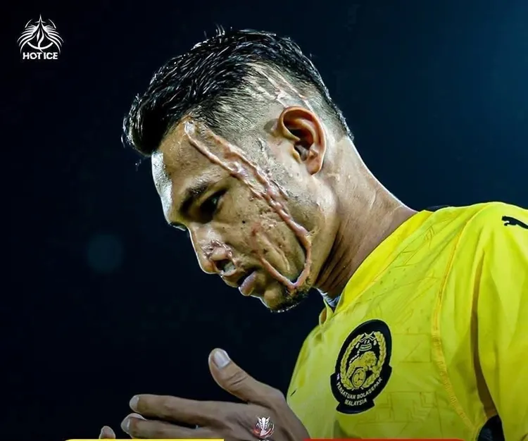 哈林重回球場的故事非常勵志。  翻攝@SyedAkramin
X