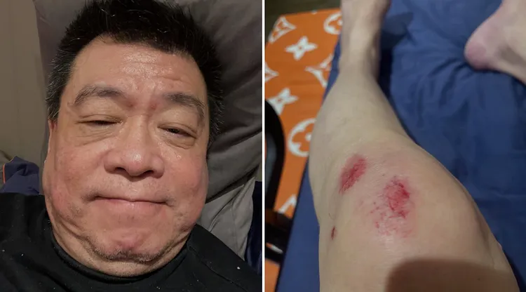孙德荣接连摔倒,脚上都是伤。翻摄孙德荣Threads