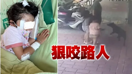 三义木雕街黑犬「咬2童」影片曝!店家未系绳 女童伤痕累累