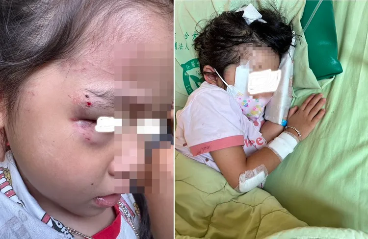民眾在臉書社團貼出女童的傷勢。翻攝臉書「我是三義人」
