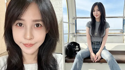 潔哥「人生最對的事」29歲開始醫美 朋友笑浪費如今她們花更多