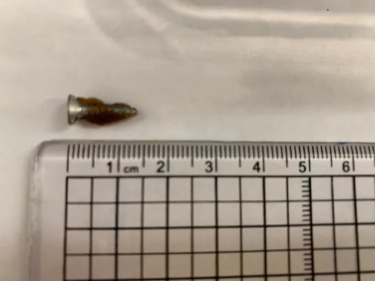 9歲兒蛋糕吃到螺絲釘，侯小姐怒向《壹蘋新聞網》投訴知名連鎖咖啡店的處理方式。侯小姐提供