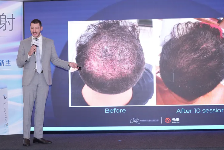 皮膚醫學專家Dr.Matheus Rodrigues講解拉髮密雷射。彭欣偉攝