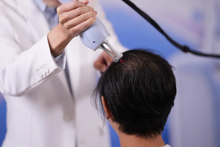 呂彥杰醫師示範操作拉髮密雷射。彭欣偉攝