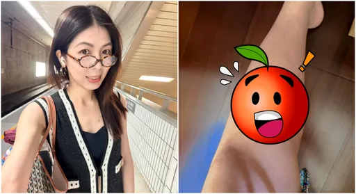 李怡贞捐掉铲子有原因!公开「伤势照」叹:老天认为我不够格