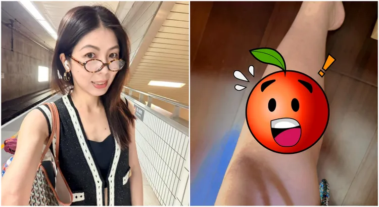 李怡贞捐掉铲子有原因！公开「伤势照」叹：老天认为我不够格