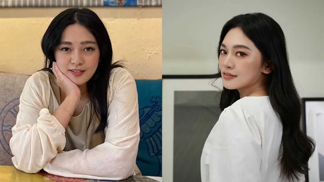 美加医美的4D眼袋抚平术深受顾客好评。(美加医美提供)