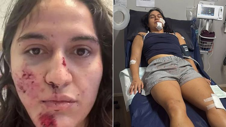 喜鵲突襲單車女騎士　她摔車「臉撞地」多處骨折險死