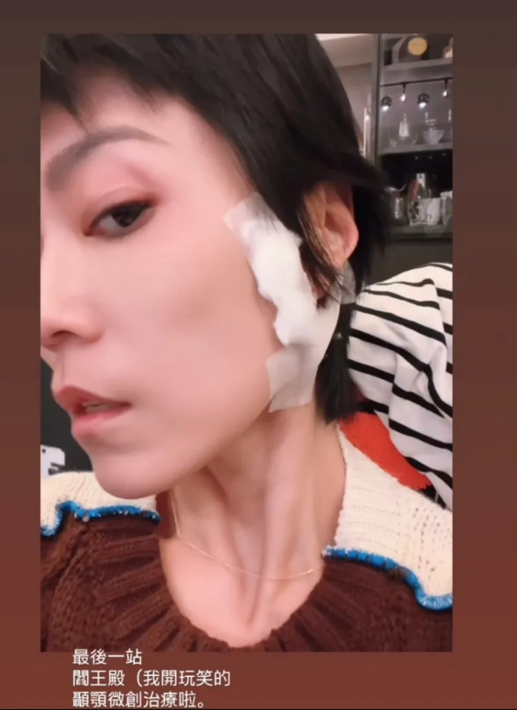 曹雅雯曬出術後近照。翻攝曹雅雯IG限動