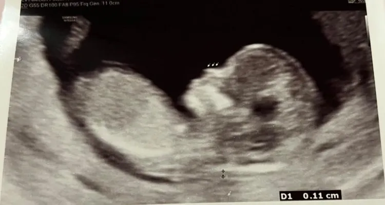 凌濤分享寶寶超音波照。翻攝凌濤臉書