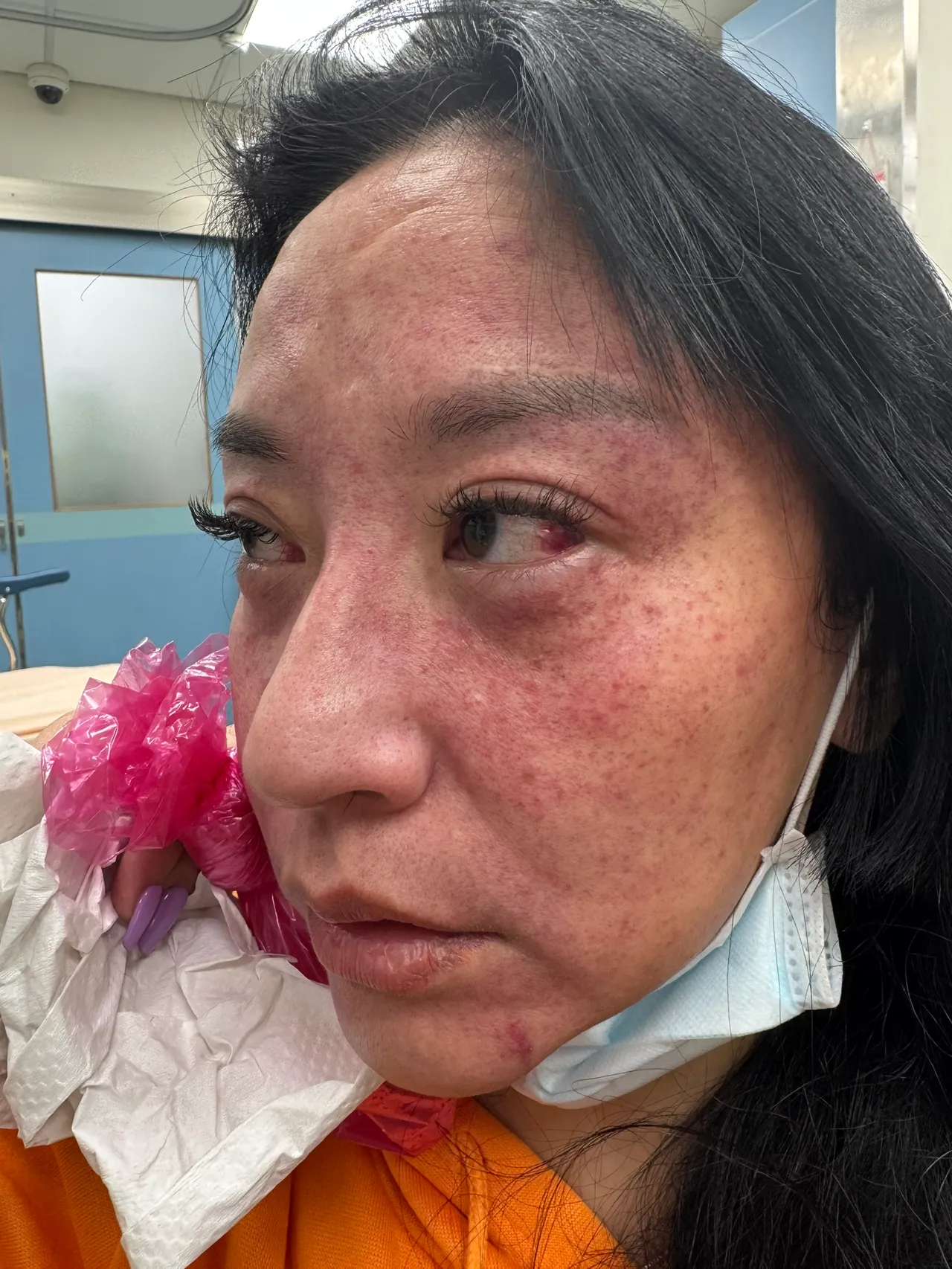 安歆沄被家暴的照片。经纪人提供