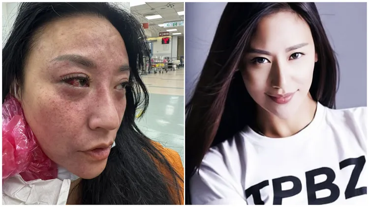 安歆沄分享现在每天都要吃药才能入眠。左图经纪人提供、右图翻摄安歆沄IG