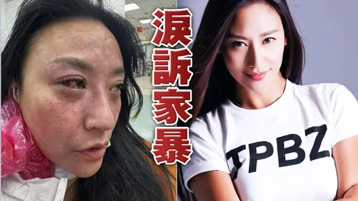獨家｜安歆澐被老公打到「整張臉爆血管」　恐懼到吃藥才能睡