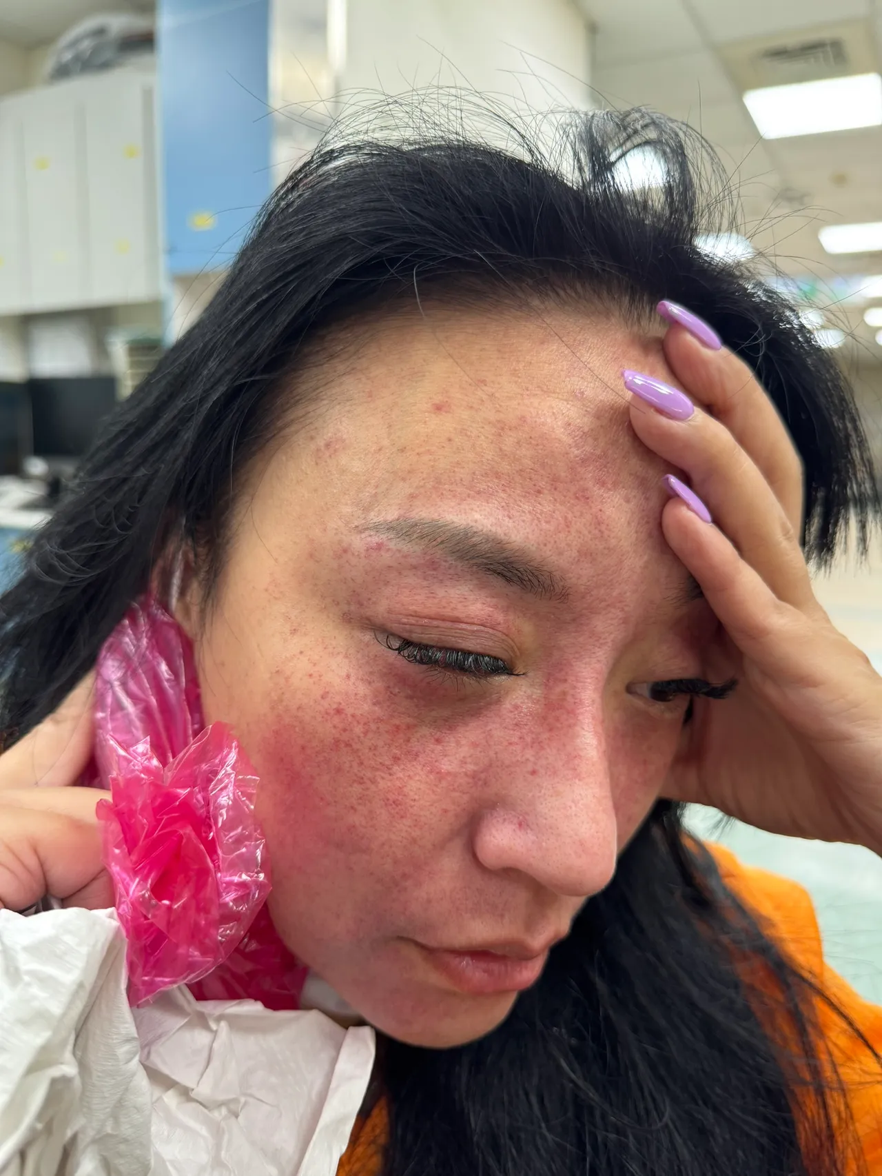 安歆沄被家暴的照片。经纪人提供