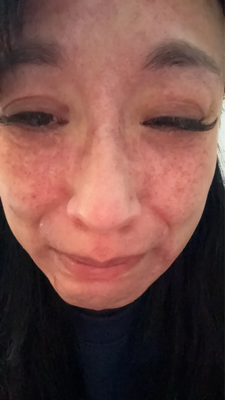 安歆澐被家暴的照片。經紀人提供