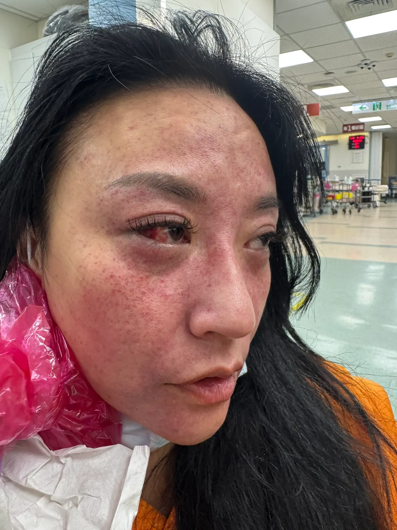 安歆沄被家暴的照片。经纪人提供