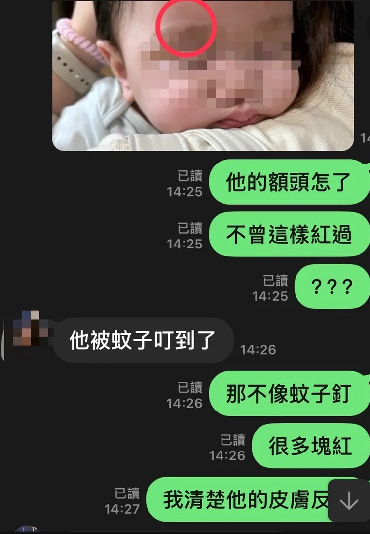 陳母發現幼兒照片頭部有明顯大片紅腫，詢問傷勢竟得到是「被蚊子叮的」。投訴人提供