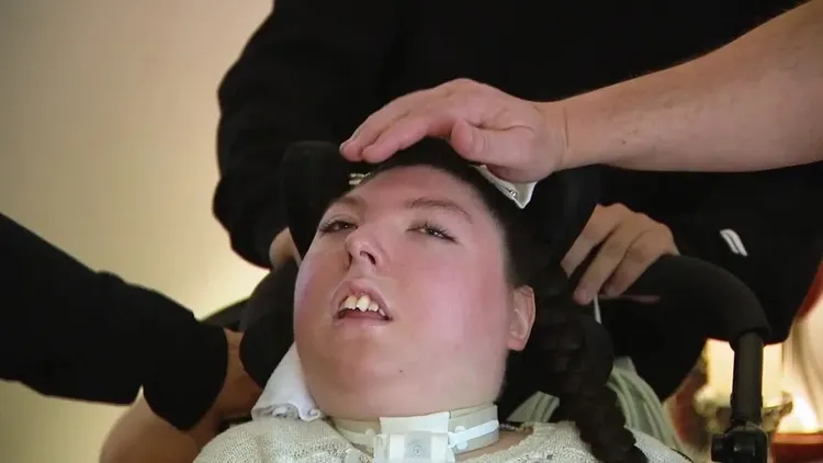 愛莉克絲的腦只有小指頭大小。翻攝自news4sanantonio