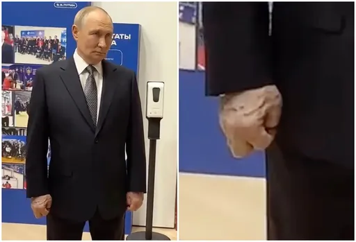 看起來怪怪的！普丁右手腫脹靜脈凸起　引發健康揣測 