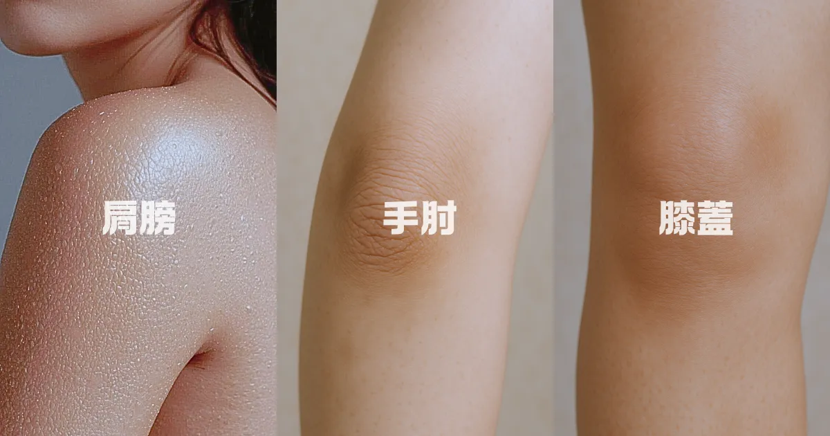 手肘膝盖易有老废角质堆积，形成丑丑的暗沈老皮；肩膀手臂肌肤也容易干糙缺水，摸起来有颗粒感甚至脱屑。