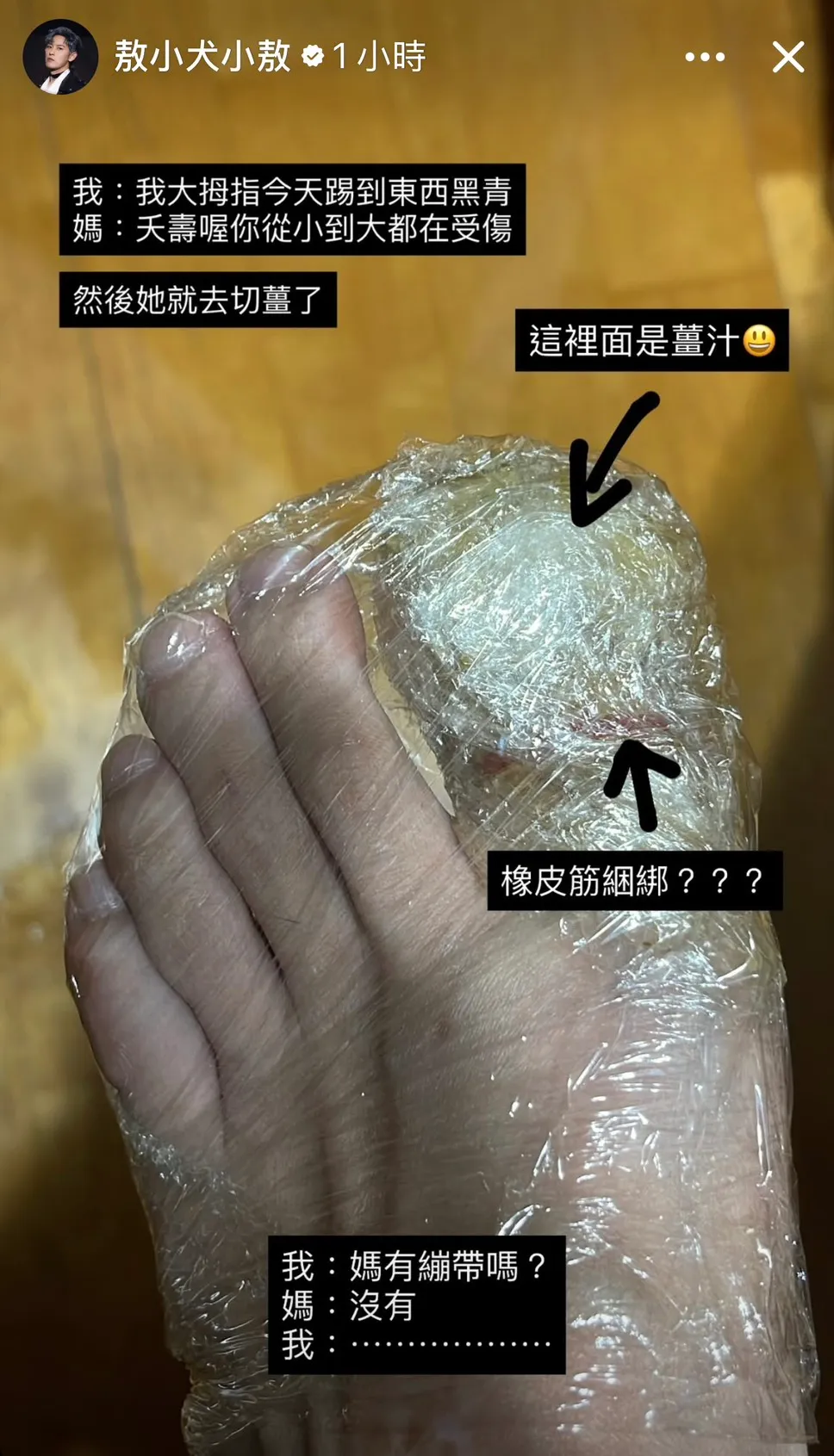 敖犬腳被保鮮膜包得緊緊的。翻攝敖犬IG限動