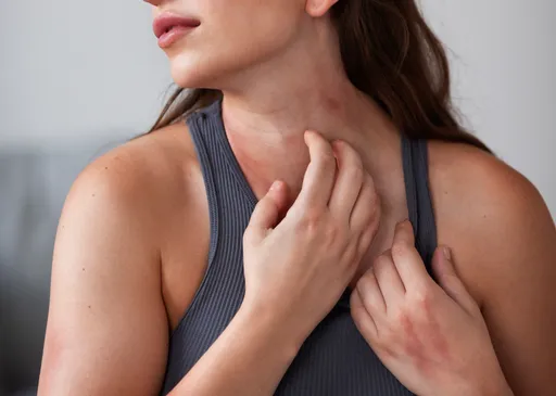 秋日肌膚拉警報　資深護理師教你「5招」遠離乾癢「危肌」