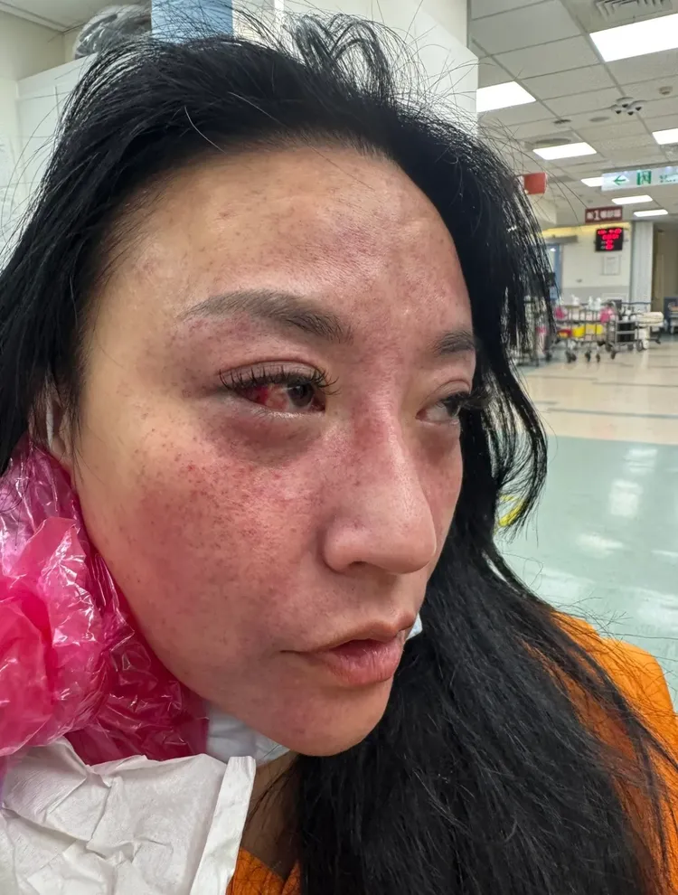 安歆澐婚後遭國手老公嚴重家暴至面目全非，還留下身心重創的後遺症。經紀人提供