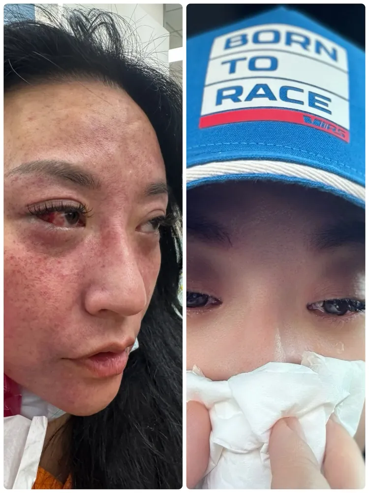 安歆沄婚后遭国手老公家暴，目前还在打离婚官司中。摘自脸书