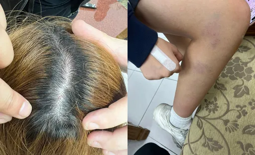 「拖行学妹」疑学长发声了！还原过程：她撞我还大笑　30个流氓在校门堵我