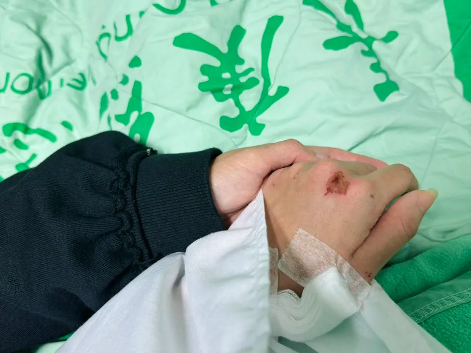 颜晓筠因车祸导致韧带断裂。翻摄自颜晓筠脸书