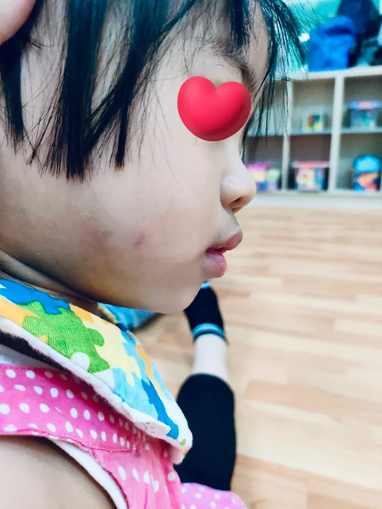 家長控訴中和某托育中心林姓托育人員對當時未滿2歲的女童有勒脖、捏臉等施暴行為，後來被輕判質疑和加害人的父親曾在社會局任職有關，社會局也跳出來澄清，表示指控子虛無有，嚴重打擊公務員清譽。翻攝畫面