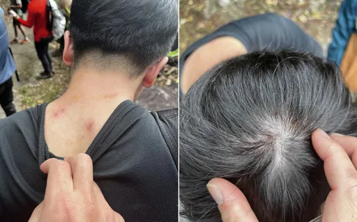 台中馬崙新山線步道虎頭蜂傷人　6登山客被螫！5人急送醫