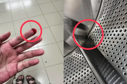 自助洗衣店溅血！三重女拿衣遭内槽刀片割伤手指　「业者拒负责」消保官说话了