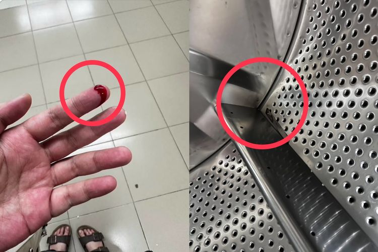 自助洗衣店濺血!三重女拿衣遭內槽刀片割傷手指 「業者拒負責」消保官說話了