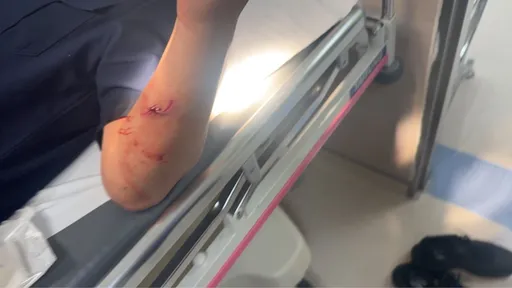 巡邏車遭衝撞　警受傷開轟6槍！逮17歲少年、駕駛逃逸