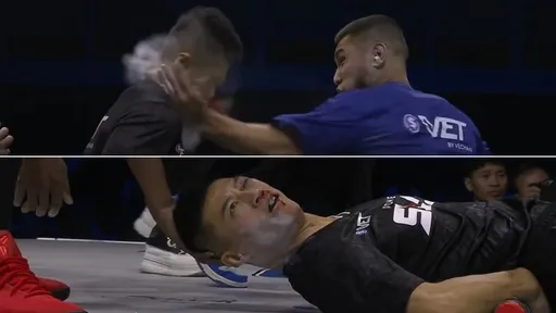 慘！通背拳大師不只被搧耳光昏迷　檢查出爐眼睛重創「完全好不可能」