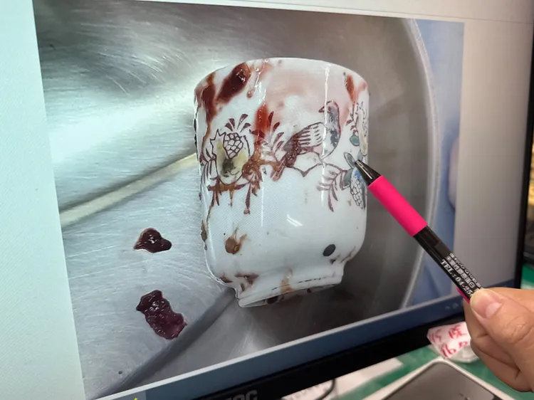 台中1名男子把陶瓷杯塞进肛门，3天无法解便，医师紧急为他动手术才取出茶杯。李综合提供