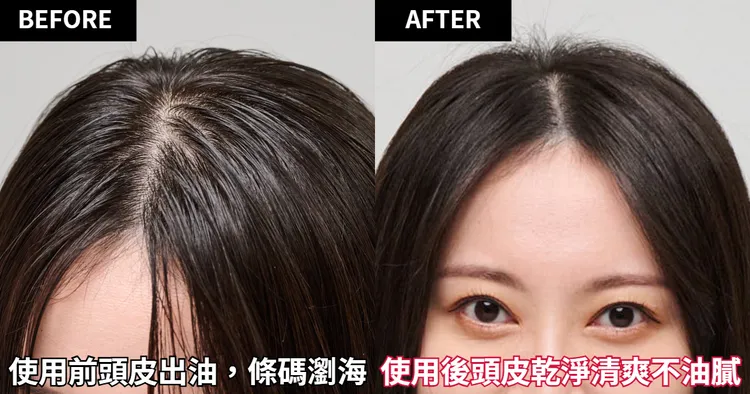 使用前頭皮出油，出現條碼瀏海，使用後頭皮乾淨了，看起來也特別清爽。