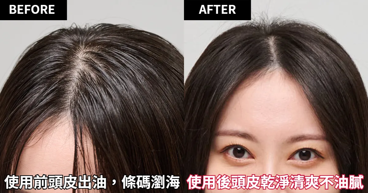 使用前頭皮出油，出現條碼瀏海，使用後頭皮乾淨了，看起來也特別清爽。