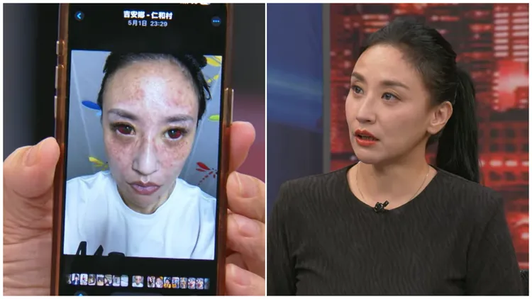 安歆沄在节目分享被家暴照片。翻摄《新闻挖挖哇！》YouTube
